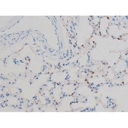 Invitrogen Phospho-p70 S6 Kinase (Ser371) Polyclonal Antibody 100 &mu;L;