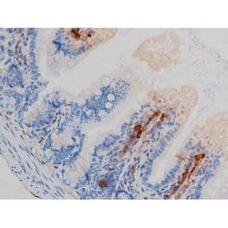 Invitrogen Phospho-p70 S6 Kinase (Ser371) Polyclonal Antibody 100 &mu;L;