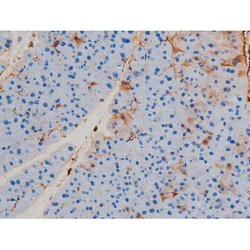 Invitrogen Phospho-p70 S6 Kinase (Ser371) Polyclonal Antibody 100 &mu;L;