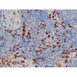 Invitrogen Phospho-p70 S6 Kinase (Ser371) Polyclonal Antibody 100 &mu;L;
