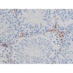 Invitrogen Phospho-p70 S6 Kinase (Ser371) Polyclonal Antibody 100 &mu;L;