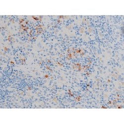 Invitrogen Phospho-p70 S6 Kinase (Ser371) Polyclonal Antibody 100 &mu;L;