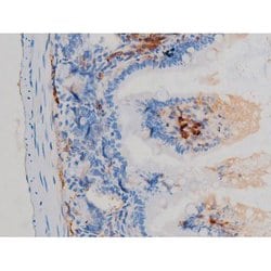 Invitrogen Phospho-p70 S6 Kinase (Ser371) Polyclonal Antibody 100 &mu;L;