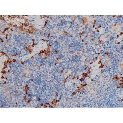 Invitrogen Phospho-p70 S6 Kinase (Ser371) Polyclonal Antibody 100 &mu;L;