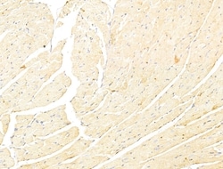 Invitrogen Phospho-p70 S6 Kinase (Thr389, Thr412) Polyclonal Antibody 100