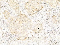 Invitrogen Phospho-p70 S6 Kinase (Thr389, Thr412) Polyclonal Antibody 100