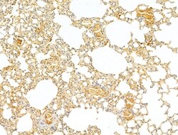 Invitrogen Phospho-p70 S6 Kinase (Thr389, Thr412) Polyclonal Antibody 100