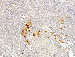Invitrogen Phospho-p70 S6 Kinase (Thr389, Thr412) Polyclonal Antibody 100