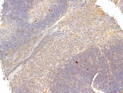 Invitrogen Phospho-p70 S6 Kinase (Thr389, Thr412) Polyclonal Antibody 100