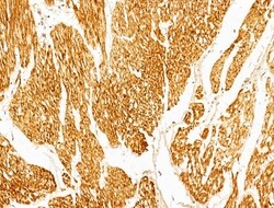 Invitrogen Phospho-p70 S6 Kinase (Thr389, Thr412) Polyclonal Antibody 100