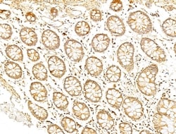 Invitrogen Phospho-p70 S6 Kinase (Thr389, Thr412) Polyclonal Antibody 100
