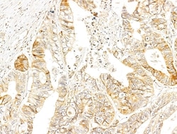 Invitrogen Phospho-p70 S6 Kinase (Thr389, Thr412) Polyclonal Antibody 100