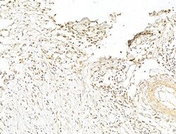 Invitrogen Phospho-p70 S6 Kinase (Thr389, Thr412) Polyclonal Antibody 100