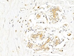 Invitrogen Phospho-p70 S6 Kinase (Thr389, Thr412) Polyclonal Antibody 100
