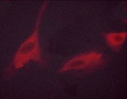 Invitrogen Phospho-p70 S6 Kinase (Thr389, Thr412) Polyclonal Antibody 100
