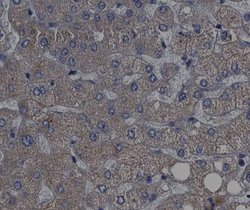 Invitrogen Phospho-p70 S6 Kinase (Thr389, Thr412) Polyclonal Antibody 100