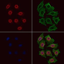 Invitrogen Phospho-p70 S6 Kinase (Ser447) Polyclonal Antibody 100 &mu;L;