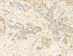 Invitrogen Phospho-CDK2 (Thr160) Polyclonal Antibody 100 &mu;L; Unconjugated:Antibodies,