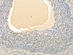 Invitrogen Phospho-CDK2 (Thr160) Polyclonal Antibody 100 &mu;L; Unconjugated:Antibodies,