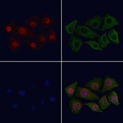 Invitrogen Phospho-CDK2 (Thr160) Polyclonal Antibody 100 &mu;L; Unconjugated:Antibodies,