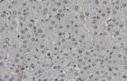Invitrogen Phospho-CDK2 (Thr160) Polyclonal Antibody 100 &mu;L; Unconjugated:Antibodies,