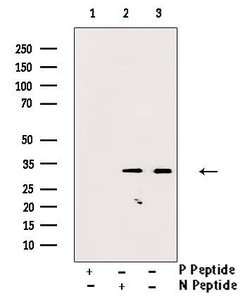 Invitrogen Phospho-CDK2 (Thr160) Polyclonal Antibody 100 &mu;L; Unconjugated:Antibodies,