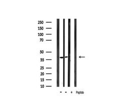 Invitrogen Phospho-IKB alpha (Tyr305) Polyclonal Antibody 100 &mu;L | Buy Online | Invitrogen&trade; | Fisher Scientific