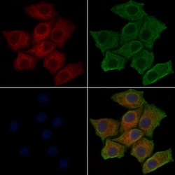 Invitrogen Phospho-PI3K p85 alpha (Tyr607) Polyclonal Antibody 100 &mu;L;