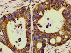 Invitrogen Phospho-PI3K p85 alpha (Tyr607) Polyclonal Antibody 100 &mu;L;