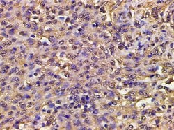 Invitrogen Phospho-PI3K p85 alpha (Tyr607) Polyclonal Antibody 100 &mu;L;