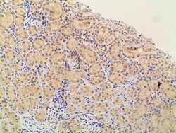 Invitrogen Phospho-PI3K p85 alpha (Tyr607) Polyclonal Antibody 100 &mu;L;