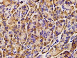 Invitrogen Phospho-PI3K p85 alpha (Tyr607) Polyclonal Antibody 100 &mu;L;