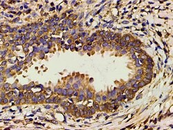Invitrogen Phospho-PI3K p85 alpha (Tyr607) Polyclonal Antibody 100 &mu;L;