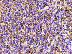 Invitrogen Phospho-PI3K p85 alpha (Tyr607) Polyclonal Antibody 100 &mu;L;