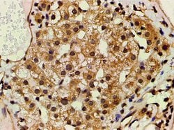 Invitrogen Phospho-PI3K p85 alpha (Tyr607) Polyclonal Antibody 100 &mu;L;