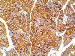 Invitrogen Phospho-PI3K p85 alpha (Tyr607) Polyclonal Antibody 100 &mu;L;