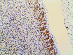 Invitrogen Phospho-PI3K p85 alpha (Tyr607) Polyclonal Antibody 100 &mu;L;