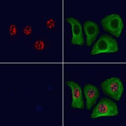 Invitrogen Phospho-MKP1/MKP2 (Ser296, Ser318) Polyclonal Antibody 100 &mu;L;