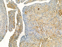 Invitrogen Phospho-eNOS (Ser1177) Polyclonal Antibody 100 &mu;L; Unconjugated:Antibodies,