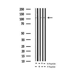 Invitrogen Phospho-eNOS (Ser1177) Polyclonal Antibody 100 &mu;L; Unconjugated:Antibodies,