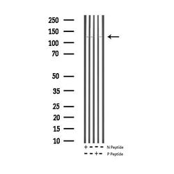 Invitrogen Phospho-eNOS (Thr495) Polyclonal Antibody 100 &mu;L; Unconjugated:Antibodies,