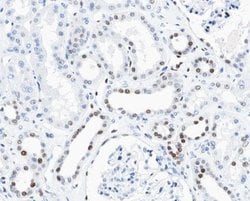 Invitrogen Phospho-Cyclin D3 (Thr283) Polyclonal Antibody 100 &mu;L; Unconjugated:Antibodies,