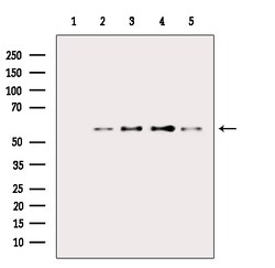 Invitrogen Phospho-AKT1 (Thr450) Polyclonal Antibody 100 &mu;L; Unconjugated:Antibodies,