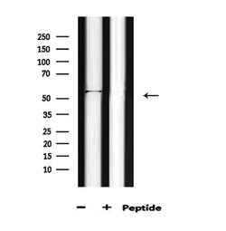 Invitrogen Phospho-AKT1 (Thr450) Polyclonal Antibody 100 &mu;L; Unconjugated:Antibodies,