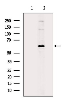 Invitrogen Phospho-AKT1 (Ser124) Polyclonal Antibody 100 &mu;L | Buy Online | Invitrogen&trade; | Fisher Scientific