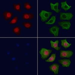 Invitrogen Phospho-AKT1 (Ser124) Polyclonal Antibody 100 &mu;L | Buy Online | Invitrogen&trade; | Fisher Scientific