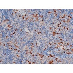 Invitrogen Phospho-AKT1 (Ser124) Polyclonal Antibody 100 &mu;L | Buy Online | Invitrogen&trade; | Fisher Scientific