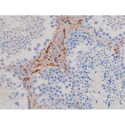 Invitrogen Phospho-AKT1 (Ser124) Polyclonal Antibody 100 &mu;L | Buy Online | Invitrogen&trade; | Fisher Scientific