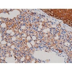 Invitrogen Phospho-AKT1 (Ser124) Polyclonal Antibody 100 &mu;L | Buy Online | Invitrogen&trade; | Fisher Scientific