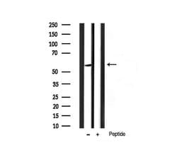 Invitrogen Phospho-AKT1 (Ser124) Polyclonal Antibody 100 &mu;L | Buy Online | Invitrogen&trade; | Fisher Scientific